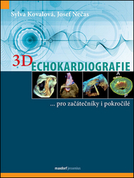 Kovalová, Sylva; Nečas, Josef - 3D Echokardiografie