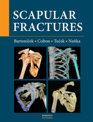 Bartoníček, Jan; Colton, Christopher; Tuček, Michal - Scapular fractures