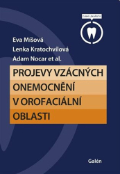 Míšová, Eva; Kratochvílová, Lenka; Nocar, Adam - Projevy vzácných onemocnění v orofaciální oblasti