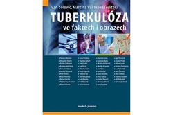 Tuberkulóza ve faktech i obrazech